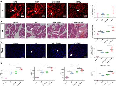 Acinar Cell-Derived Extracellular Vesicle MiRNA-183-5p Aggravates Acute Pancreatitis by Promoting M1 Macrophage Polarization Through Downregulation of FoxO1